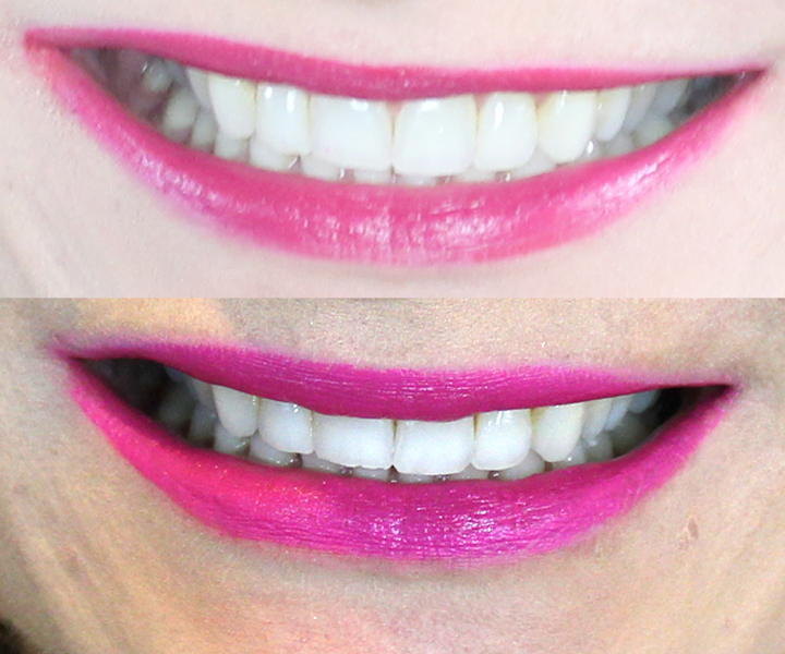 smilebrilliant-beforeandafter-results-leahtackles.jpeg